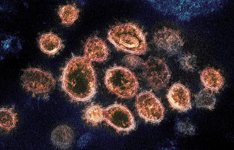 FILE - This 2020 electron microscope image provided by the National Institute of Allergy and Infectious Diseases - Rocky Mountain Laboratories shows SARS-CoV-2 virus particles which cause COVID-19, isolated from a patient in the U.S., emerging from the surface of cells cultured in a lab.  Pfizer says its experimental pill for COVID-19 cut rates of hospitalization and death by nearly 90% among patients with mild-to-moderate infections. The company announced Friday, Nov. 5, 2021 it will soon ask the U.S. Food and Drug Administration and international regulators to authorize its pill, which is taken twice a day for five days. (NIAID-RML via AP)