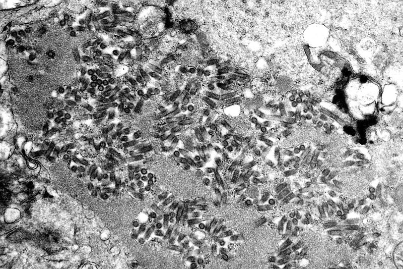 This undated electron microscope image made available by the Centers for Disease Control and Prevention shows rabies virions, dark and bullet-shaped, within an infected tissue sample. Five Americans died of rabies in 2021 &#x2014; the largest number in a decade &#x2014; and health officials say some occurred because people didn&#x2019;t realize they&#x2019;d been infected or refused life-saving shots. (F. A. Murphy/CDC via AP)