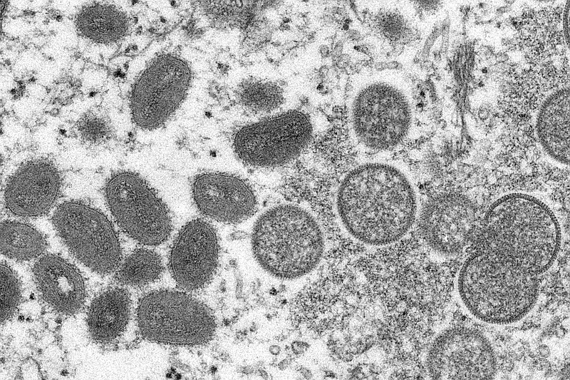 FILE - This 2003 electron microscope image made available by the Centers for Disease Control and Prevention shows mature, oval-shaped monkeypox virions (left) and spherical immature virions (right) obtained from a sample of human skin associated with the 2003 prairie dog outbreak. (Cynthia S. Goldsmith, Russell Regner/CDC via AP, File)