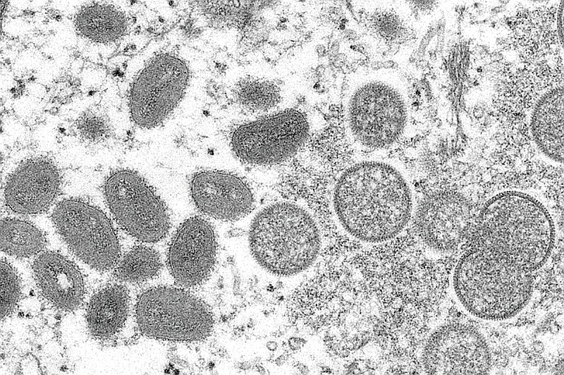 Esta imagen de microscopio electrónico de 2003 proporcionada por los Centros para el Control y la Prevención de Enfermedades muestra viriones maduros de viruela del simio de forma ovalada (izquierda) y viriones inmaduros esféricos (derecha) obtenidos de una muestra de piel humana asociada con un brote de perros de las praderas en 2003. (Cynthia S. Goldsmith, Russell Regner/CDC vía AP, Archivo)