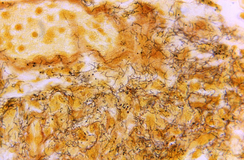 This 1966 microscope photo made available by the Centers for Disease Control and Prevention shows a tissue sample with the presence of numerous, corkscrew-shaped, darkly-stained, Treponema pallidum spirochetes — the bacterium responsible for causing syphilis. U.S. health officials on Monday, Sept. 19, 2022, are calling for a new push to prevent sexually transmitted diseases — spurred in part by a 26% increase in syphilis cases last year. (Skip Van Orden/CDC via AP)