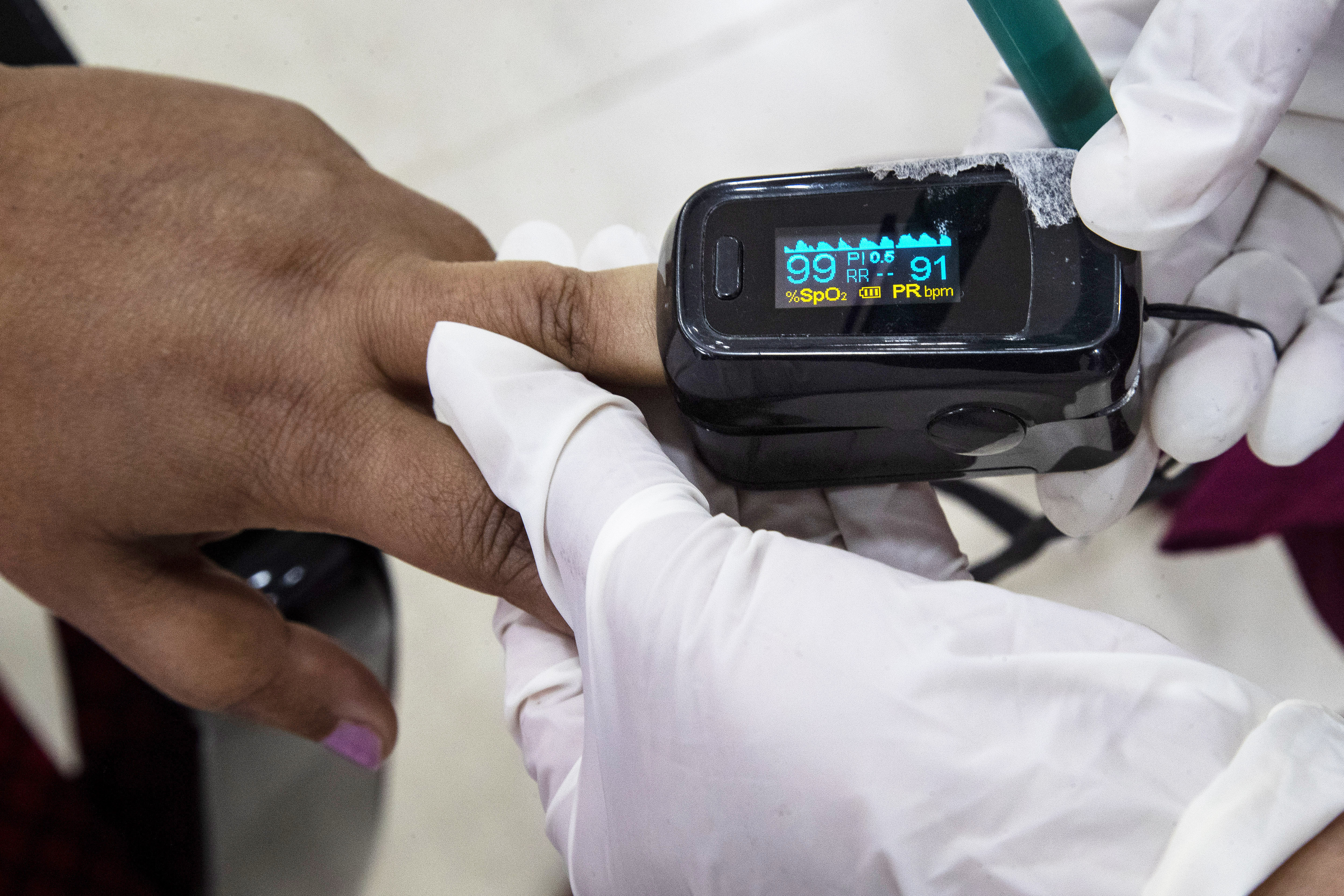 FDA advisers meet on racial disparities in pulse oximeters - Vimarsana News