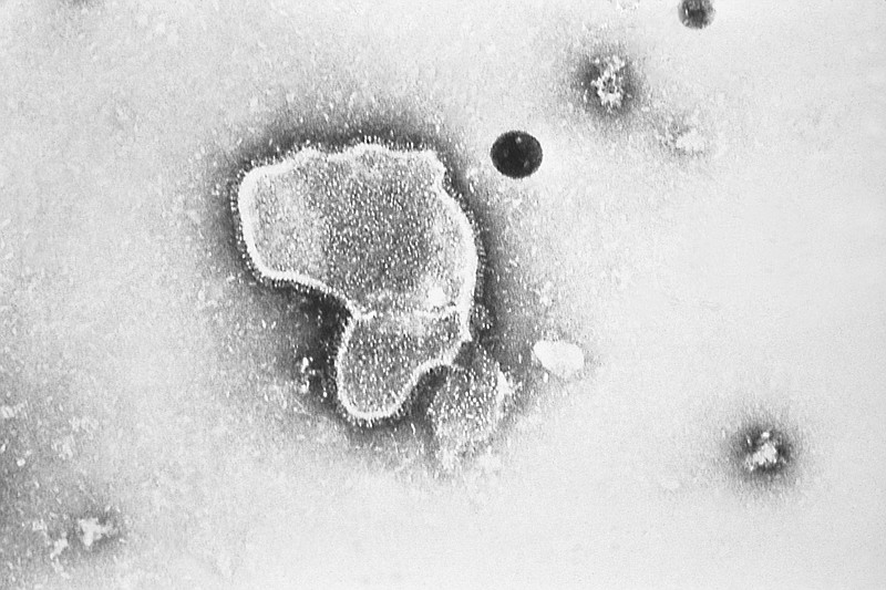 This 1981 photo provided by the Centers for Disease Control and Prevention (CDC) shows an electron micrograph of Respiratory Syncytial Virus, also known as RSV. Children's hospitals in parts of the country are seeing a distressing surge in RSV, a common respiratory illness that can cause severe breathing problems for babies. Cases fell dramatically two years ago as the pandemic shut down schools, day cares and businesses. Then, with restrictions easing, the summer of 2021 brought an alarming increase in what is normally a fall and winter virus. (CDC via AP)