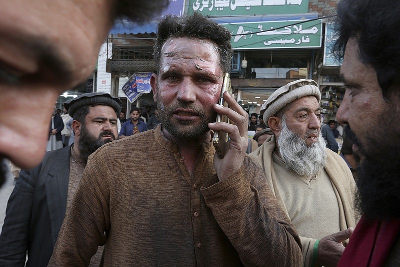 AP An injured victim of a suicide bombing talks on his mobile phone after getting initial treatment Monday outside a hospital in Peshawar, Pakistan. A suicide bomber struck Monday inside a mosque in the northwestern Pakistani city of Peshawar, killing multiple people and wounding scores of worshippers, officials said.