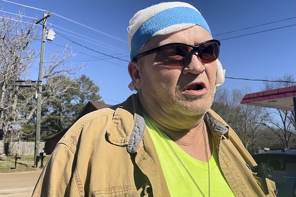 Survivor recounts home attack - Vimarsana News