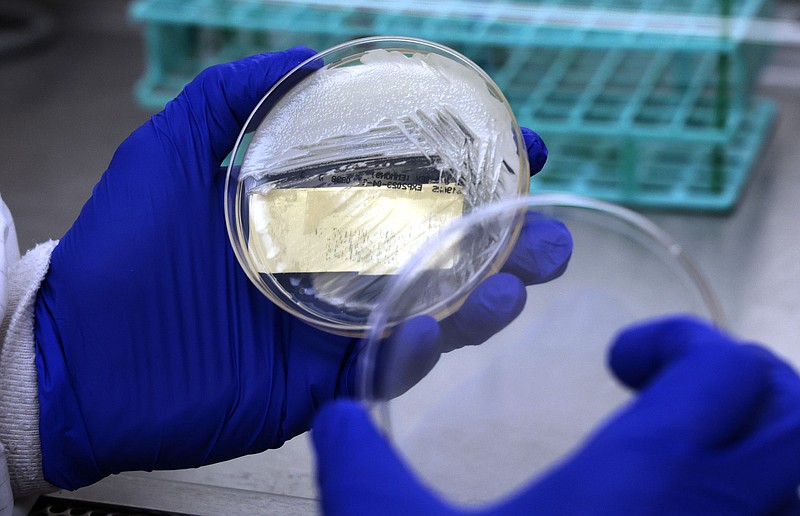 Medical technologist Mitan Shah looks over a cultural plate as he performs a testing process for Candida auris in the microbiology/virology lab Friday, March 24, 2023, at Stroger Hospital in Chicago. (Photo by Antonio Perez/Chicago Tribune)