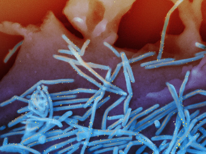 This electron microscope image provided by the National Institutes of Health shows human respiratory syncytial virus (RSV) virions, colorized blue, and anti-RSV F protein/gold antibodies, colorized yellow, shedding from the surface of human lung cells. The U.S. approved the first vaccine for RSV on Wednesday, May 3, 2023 shots to protect older adults against a respiratory virus thats most notorious for attacking babies but endangers their grandparents, too. (National Institute of Allergy and Infectious Diseases, NIH via AP)
