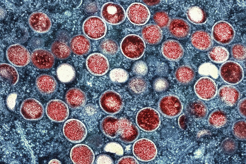 FILE - This colorized electron microscope image provided by the National Institute of Allergy and Infectious Diseases shows mpox particles, red, found within an infected cell, blue, cultured in a laboratory in Fort Detrick, Md. A study released by the U.S. Centers for Disease Control and Prevention on Thursday, May 25, 2023, suggests dozens of U.S. cities are at risk for mpox outbreaks this summer. Health officials say they are working to prevent the scale of infections that surprised the nation the previous summer. (NIAID via AP, File)