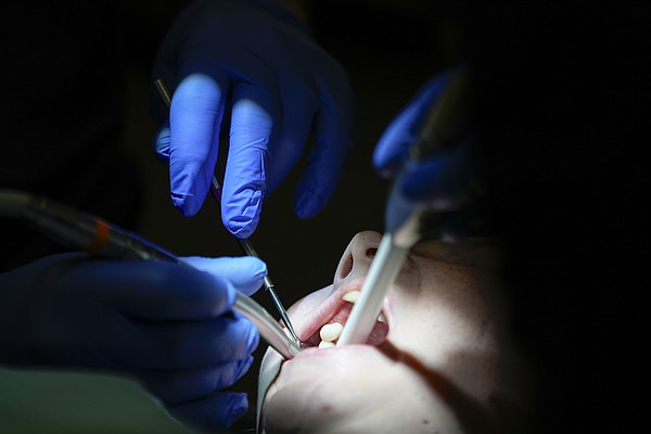 Many states expand Medicaid programs to provide dental care to poorest residents