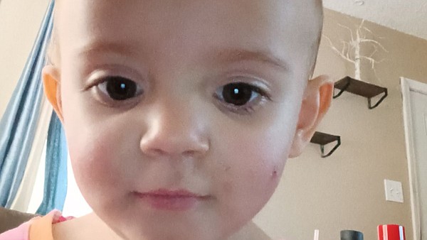Fort Worth toddler attacked by pit bull after CPS removed her from family - Vimarsana News