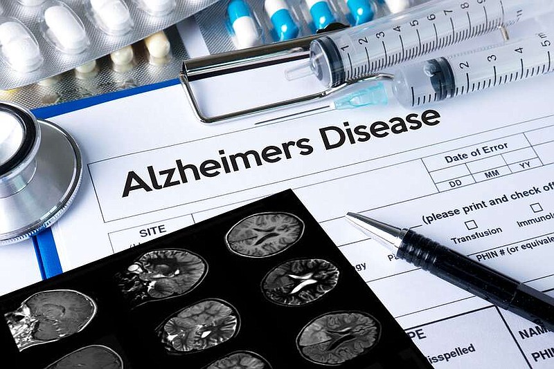 Nearly 12% of Texas seniors in 2020 were living with Alzheimer's disease. (Dreamstime/TNS)