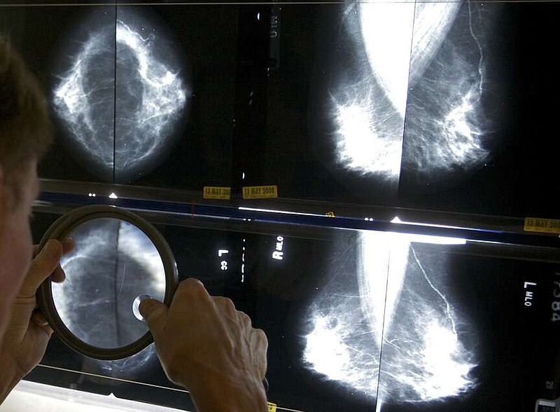 Task force says mammograms should start at 40 to address rising breast ...