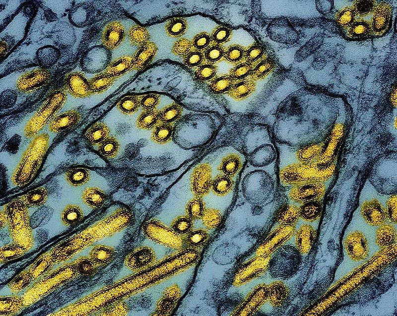 This colorized electron microscope image released by the National Institute of Allergy and Infectious Diseases on March 26, 2024, shows avian influenza A H5N1 virus particles (yellow), grown in Madin-Darby Canine Kidney (MDCK) epithelial cells (blue). (CDC/NIAID via AP, File)