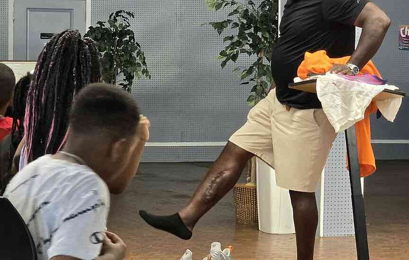 The Rev. Charles Banks reveals a scar on his leg, explaining he had been shot and stabbed. (Pine Bluff Commercial/Eplunus Colvin)