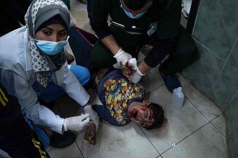 FILE.- A wounded Palestinian child is brought to Al-Najjar hospital in Rafah, southern Gaza Strip, on Feb. 24, 2024. (AP Photo/Fatima Shbair,File)