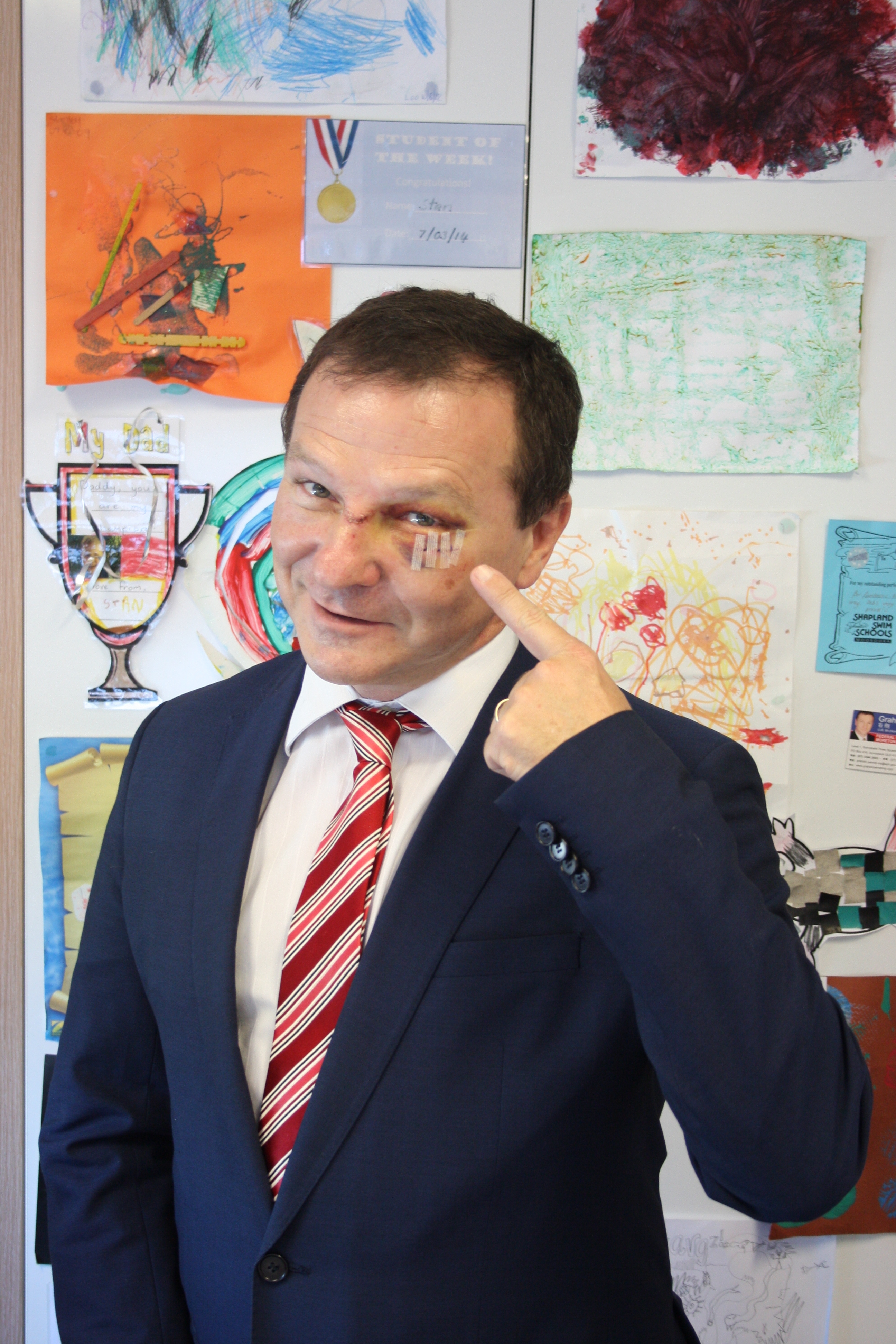 LIGHT LUNCH: Man chokes, gets black eye from laughing at TV show