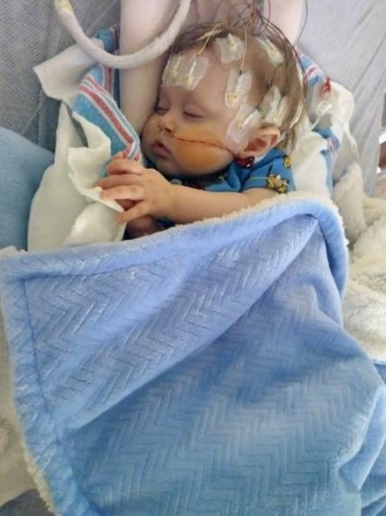 Meet Jaxxon, an 11-month-old Ohio boy in need of a heart transplant