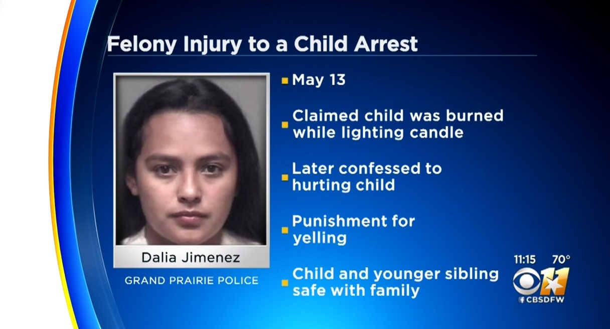 Texas woman accused of setting stepdaughter’s face on fire