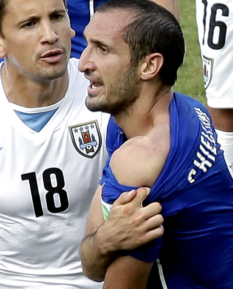 World Cup stunning moments: Luis Suárez bites Giorgio Chiellini in 2014, Soccer