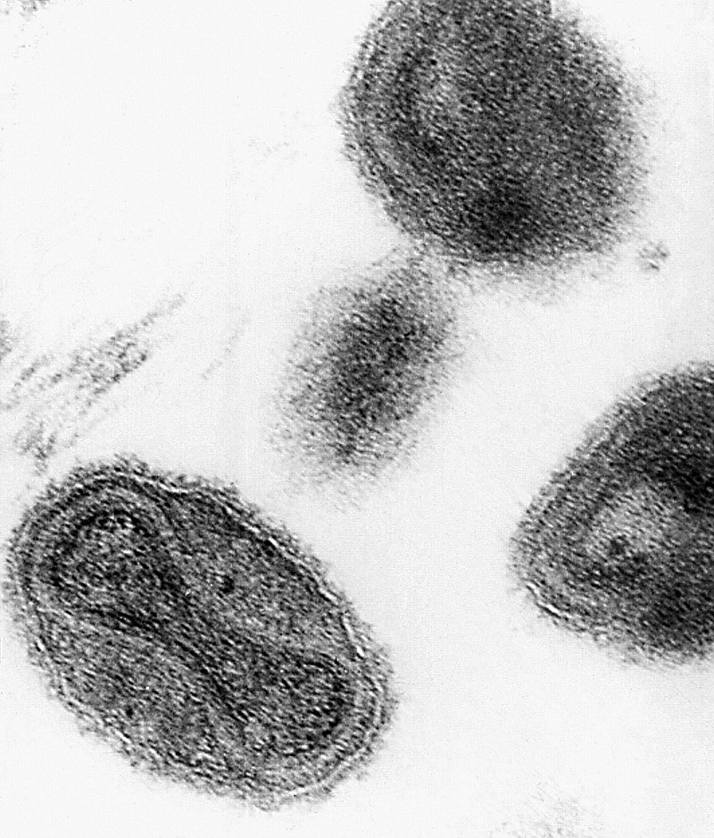 A photo of the smallpox virus taken by a microscope.