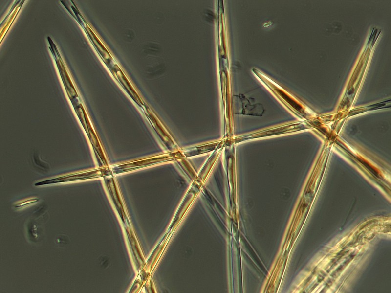 
              In this undated handout microscopy photo provided by NOAA Fisheries, the algae pseudo-nitzchia, which produces the toxic domoic acid, is seen from an algae bloom sample that the NOAA ship Bell M. Shimada collected during its survey this summer on the West Coast. One of the largest toxic algae blooms recorded off the West Coast is much denser, more widespread and may go extend deeper than initially thought, say scientists who surveyed the event aboard a National Oceanic and Atmospheric Administration research vessel. (NOAA Fisheries via AP)
            