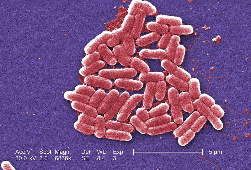 A strain of E. coli from Chinese pigs heavily treated with antibiotics appears to be resistant to all antibiotics, according to respected medical journal The Lancet