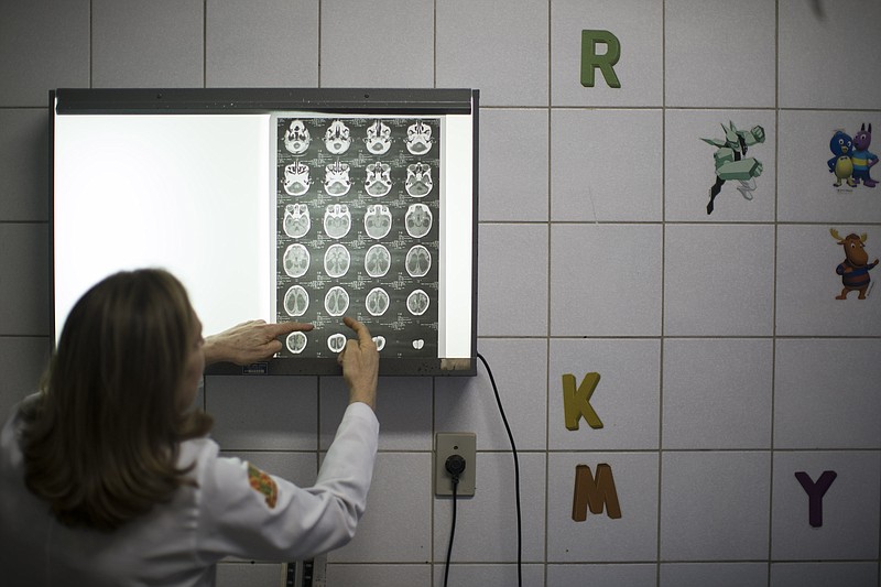 
              Doctor Angela Rocha shows brain scans of a baby born with microcephaly at the Oswaldo Cruz Hospital in Recife, Brazil, Thursday, Jan. 28, 2016. Brazilian officials still say they believe there's a sharp increase in cases of microcephaly and strongly suspect the Zika virus, which first appeared in the country last year, is to blame. The concern is strong enough that the U.S. Centers for Disease Control and Prevention this month warned pregnant women to reconsider visits to areas where Zika is present. (AP Photo/Felipe Dana)
            