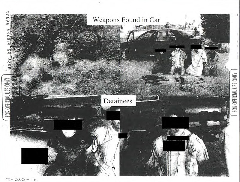 
              This image provided by the Department of Defense shows one of the 198 photos of detainees in Iraq and Afghanistan, involving 56 cases of alleged abuse by U.S. forces, that were released Friday, Feb. 5, 2016, in response to a Freedom of Information request from the American Civil Liberties Union. The often dark, blurry and grainy pictures are mainly of detainees' arms and legs, with faces redacted by the military, revealing bruises and cuts, and they appear far less dramatic than those released more than a decade ago during allegations of torture at Iraq's Abu Ghraib prison. (Department of Defense via AP)
            