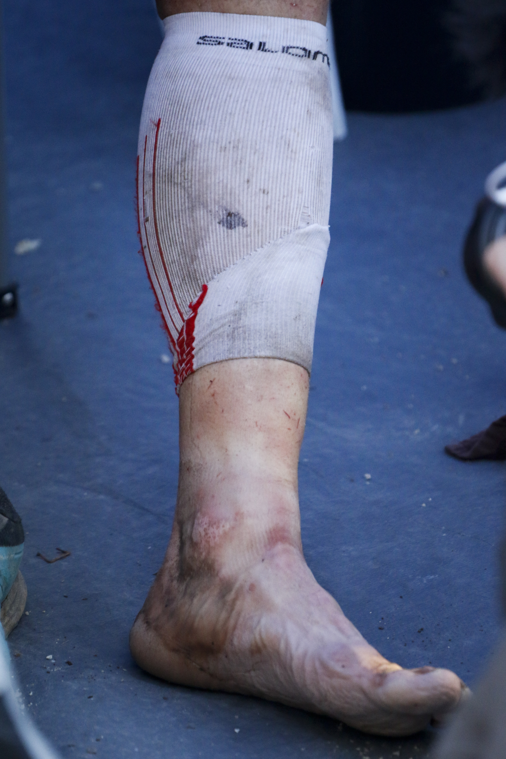 Staff Photo by Dan Henry / The Chattanooga Times Free Press- 4/3/16. Gary Robbins winces in pain as he swaps out socks before heading out on his fifth loop during the 30th running of the Barkley Marathons at Frozen Head State Park in Warburg, Tenn., on April 3, 2016. Robbins completed four and a half loops before pulling himself from the race due hallucinations from lack of sleep. The Barkley Marathons is part orienteering, part ultra marathon where a select few attempt to complete up to five 20 mile loops within a 60-hour time limit where they search for hidden book caches deep in the woods throughout the park.