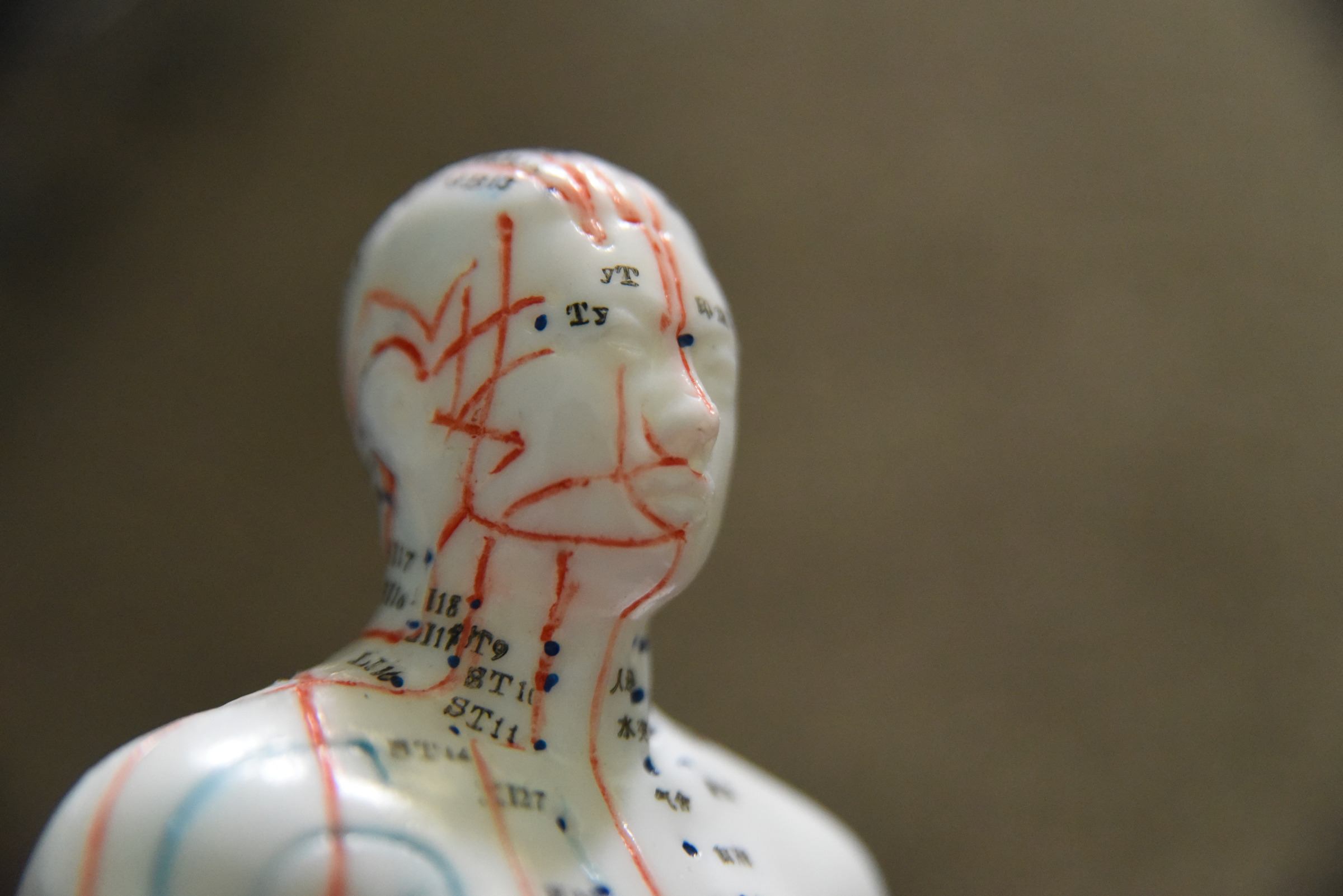 At Yin Yang House Acupuncture and Wellness Center, Chad Dupuis uses acupuncture dolls to help patients understand where the needles are going to be placed for allergy relief.