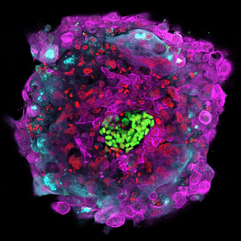 
              This microscope photo provided by The Rockefeller University shows a human embryo 12 days after fertilization in vitro, with different cell types marked by separate colors. Scientists have gotten their first good look at a crucial stage in the development of human embryos, a step that could help clear up mysteries about the early days of a person's life. (Gist Croft, Alessia Deglincerti, Ali H. Brivanlou/The Rockefeller University via AP)
            