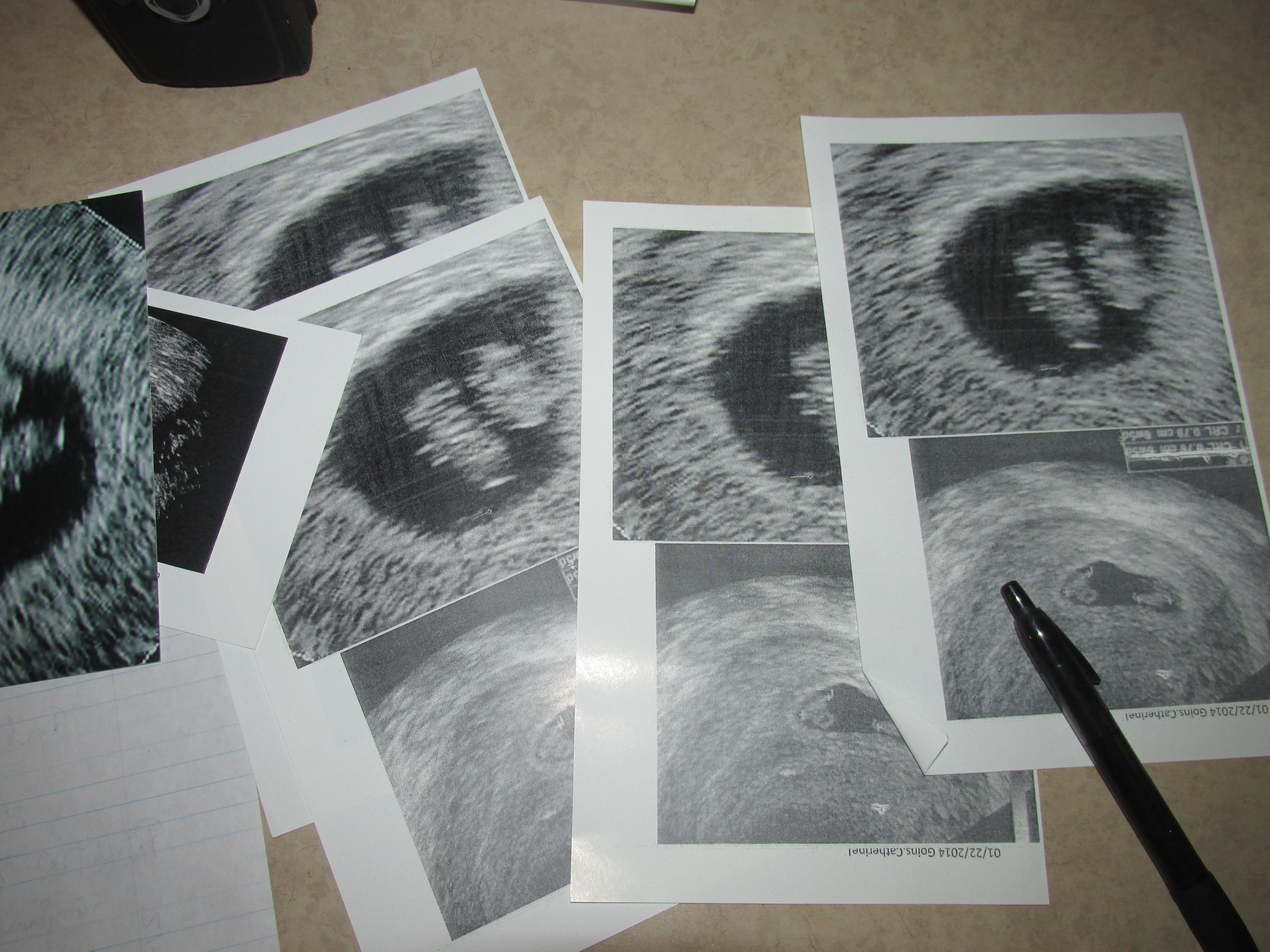 Ultrasound pictures that investigators found in Catherine Goins' possession. They had her name above it as well as a date from January 2014. The Catoosa County Sheriff's Office could not confirm whether Goins had been pregnant in the months before she killed Natalia Roberts.