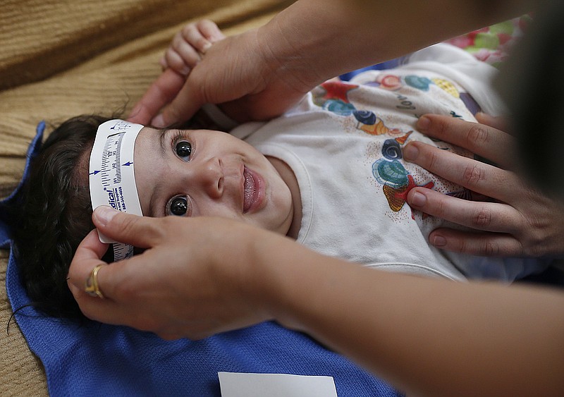 
              FILE - In this Wednesday, Feb. 24, 2016 file photo, 3-month-old Esther Kamilly has her head measured by Brazilian and U.S. health workers from the United States' Centers for Disease Control and Prevention (CDC) at her home in Joao Pessoa, Brazil, as part of a study on the Zika virus and the birth defect microcephaly. As the international epidemic of Zika has unfolded and led to devastating birth defects for at least 1,300 children in eight countries, an agonizing question has persisted: What is the chance that an infected pregnant woman will have a baby with these defects? (AP Photo/Andre Penner)
            