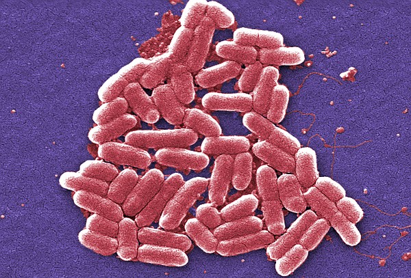 Bacteria found in U.S. could become immune to all current antibiotics, health officials warn | Chattanooga Times Free Press