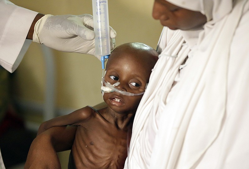 
              FILE- In this Monday, Aug. 29, 2016 file photo, a doctor feeds a malnourished child at a feeding centre run by Doctors Without Borders in Maiduguri, Nigeria. As many as 75,000 children will die over the next year in famine-like conditions created by Boko Haram if donors don’t respond quickly, the U.N. Children’s Fund is warning. (AP Photo/Sunday Alamba, File)
            