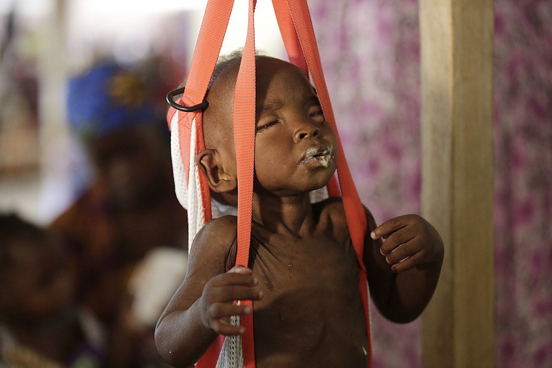 
              FILE - In this Monday, Aug. 29, 2016 file photo, a malnourished child is weighed on a scales at a clinic run by Doctors Without Borders in Maiduguri, Nigeria. The United Nations children's agency warned Tuesday, Feb. 21, 2017 that almost 1.4 million children are at "imminent risk of death" as famine threatens parts of South Sudan, Nigeria, Somalia and Yemen. (AP Photo/Sunday Alamba, File)
            