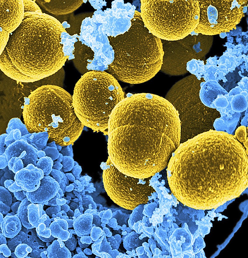 
              This digitally colorized microscope image provided by the National Institute of Allergy and Infectious Diseases (NIAID) shows Staphylococcus aureus bacteria in yellow. New research found protective bacteria in healthy skin produce natural antibiotics that can guard against disease-causing Staph aureus. (National Institute of Allergy and Infectious Diseases via AP)
            
