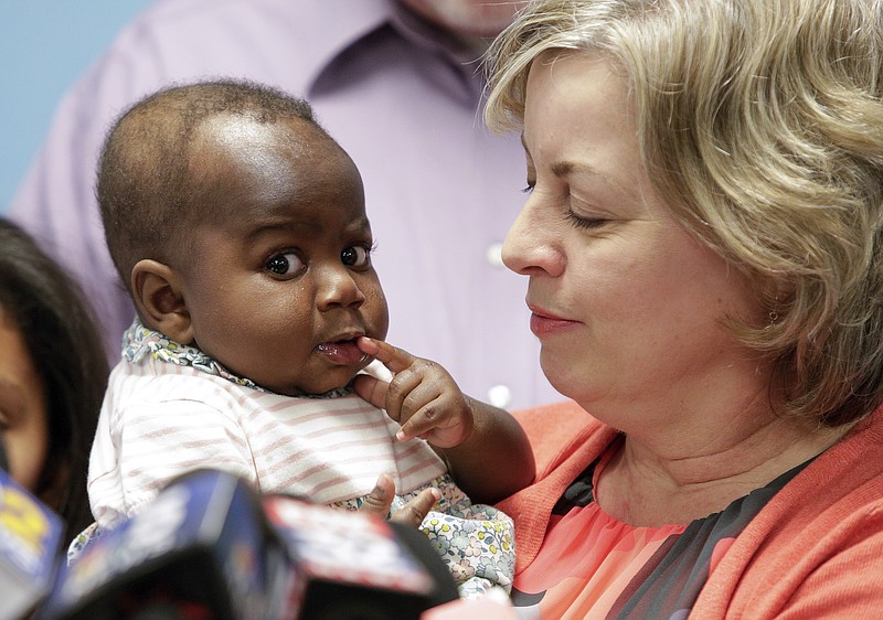 
              Foster mom Nancy Swabb holds Dominique, a 10-month-old baby born with two spines and an extra set of legs protruding from her neck during a news conference, Tuesday, March 21, 2017, at Advocate Children's Hospital in Park Ridge, Ill. The baby, who was born in Ivory Coast, West Africa, underwent surgery at the hospital on March 8 to remove the remnants of her conjoined twin. She will return to her family in West Africa and is expected to live a normal life. (AP Photo/Teresa Crawford)
            