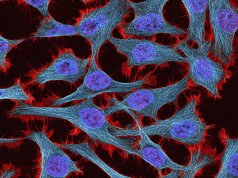 
              This undated microscope image made available by the National Center for Microscopy and Imaging Research shows HeLa cells. Until these cells came along, whenever human cells were put in a lab dish, they would die immediately or reproduce only a few times. Henrietta Lacks' cells, by contrast, grew indefinitely. They were "perpetual, everlasting, death-defying, or whatever other word you want to use to describe immortal," says Dr. Francis Collins, director of the U.S. National Institutes of Health. (National Center for Microscopy and Imaging Research via AP)
            