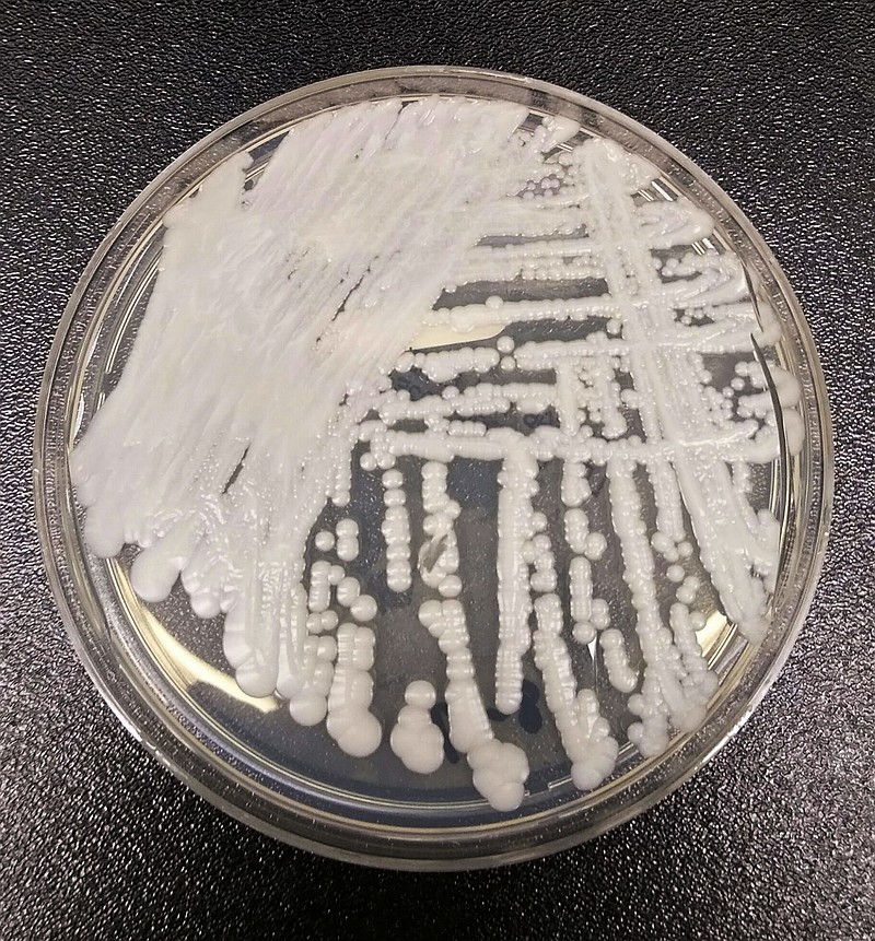 
              This undated photo made available by the Centers for Disease Control and Prevention shows a strain of Candida auris cultured in a petri dish at a CDC laboratory. On Tuesday, April 25, 2017, New York state health officials provided new details about a continuing outbreak of the infection. The count is 44 now, up from a half dozen last fall. The fungus is a harmful form of yeast that was first seen in a patient in 2009, in Japan. Scientists say it can be hard to identify with standard lab tests, and more cases are being reported as doctors are looking harder for it. (Shawn Lockhart/CDC via AP)
            