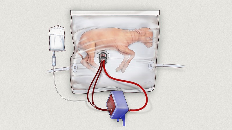 
              In this drawing provided by the Children’s Hospital of Philadelphia, an illustration of a fluid-filled incubation system that mimics a mother’s womb, in hopes of one day improving survival of extremely premature babies. In animal testing, fetal lambs grew for up to four weeks inside a bag filled with a substitute for amniotic fluid, while the heart pumped blood into a machine attached to the umbilical cord that supplied oxygen like a placenta normally would. (Children’s Hospital of Philadelphia via AP)
            