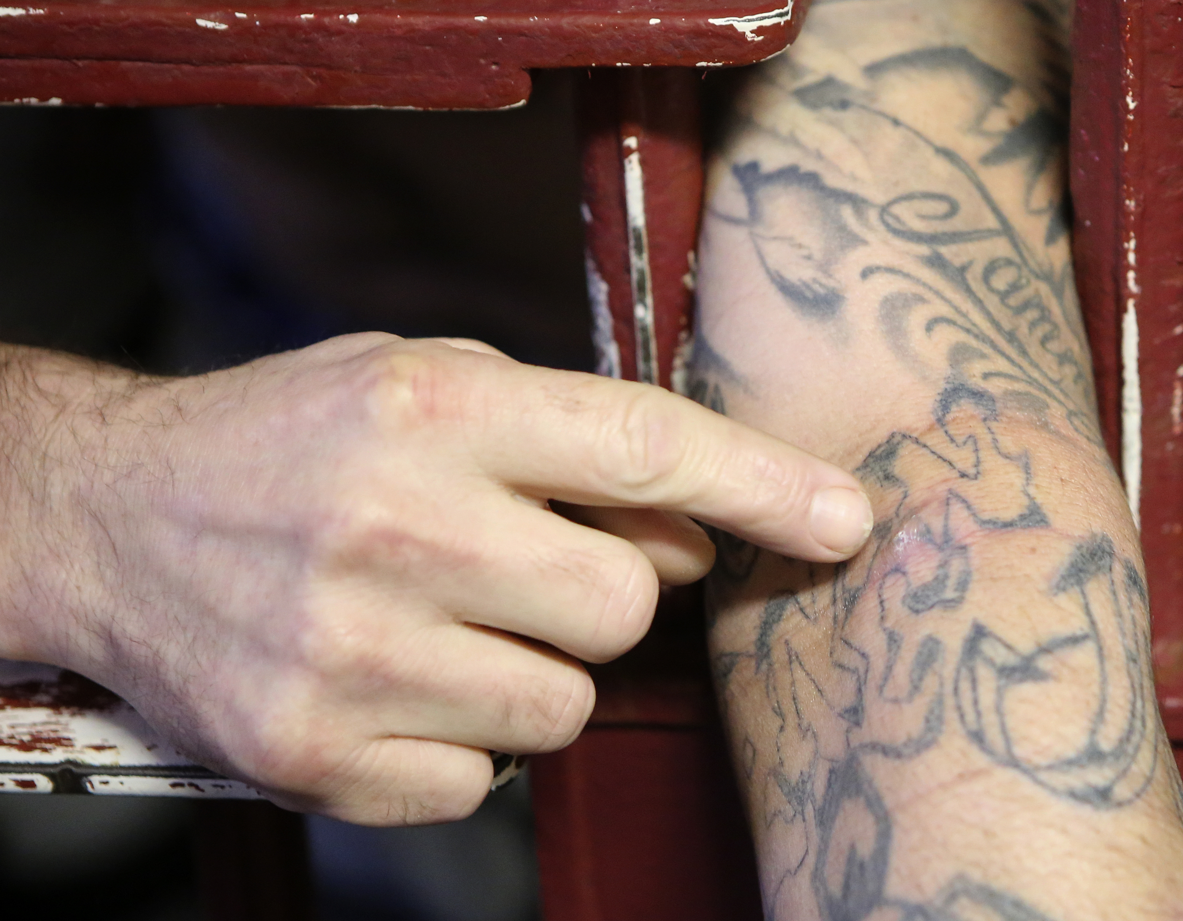Solomon Valiz points to a spot on his arm which he claims is from a staph infection at the Rhea County Jail on Wednesday, June 28, in Dayton, Tenn. Over 200 inmates are housed at the jail which is only approved to house 87.