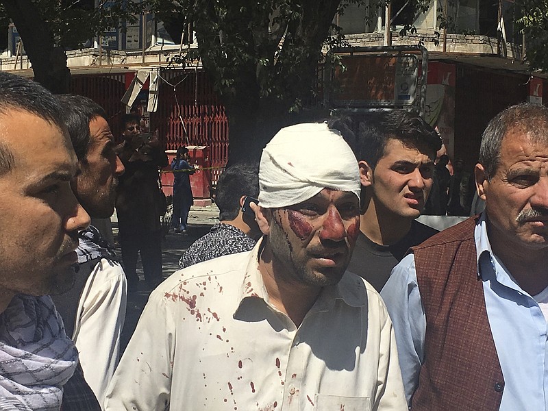 
              FILE -- In this May 31, 2017 file photo, an injured man is seen after an explosion in Kabul, Afghanistan. A U.N. report released Monday, July 17, 2017, said Afghanistan's protracted war killed a record number of civilians during the first six months of this year, blaming the majority of the deaths on bombings by insurgents. U.N. High Commissioner for Human Rights Zeid Ra'ad Al Hussein says the "horrifying" figure of 1,662 people killed between January and June of this year "can never fully convey the sheer human suffering of the people of Afghanistan." (AP Photo/Rahmat Gul, File)
            