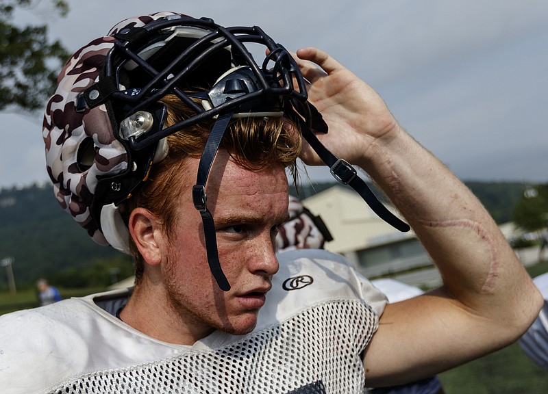 Player Zach Vanmeter wears a helmet equipped with a "guardian cap" on the sidelines during the Chargers' football scrimmage at Chattanooga Christian School on Thursday, July 27, 2017, in Chattanooga, Tenn. Guardian caps, which are used to mitigate the effects of concussions and blows to the head in football, are seeing increased use as concerns mount about head injuries in the sport.