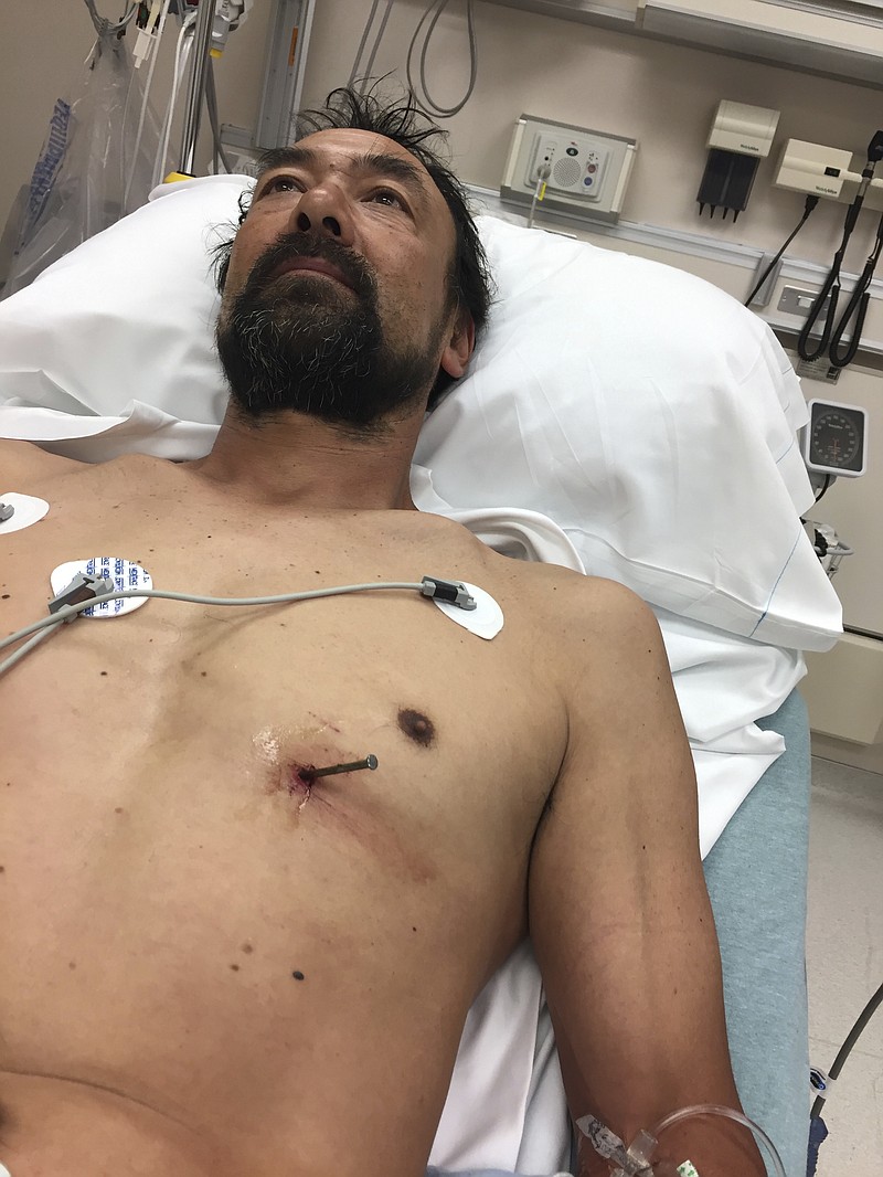 
              This photo provided by Donna Bergeson on June 25, 2017, her husband Doug Bergeson lies on a hospital bed at Aurora BayCare Medical Center in Green Bay, Wis., before a doctor removed a nail from his heart. He had accidentally shot it into his heart earlier in the day while working on a new house in Peshtigo, Wis. He survived and is going back to work this week. (Donna Bergeson via AP)
            