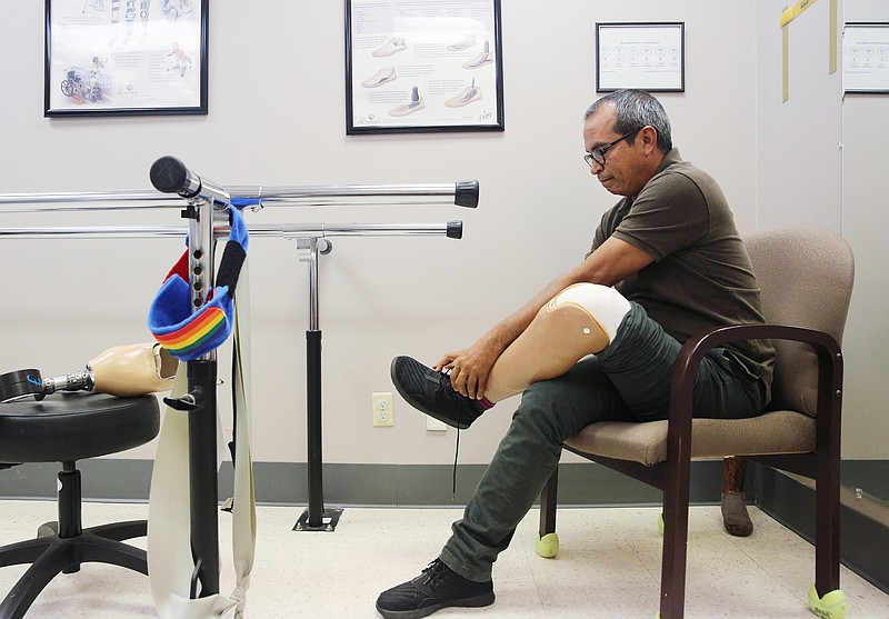 Luis Soriano takes off his old prosthetic leg as he is asked to try on his new one for the final fitting Thursday, Oct. 26, 2017, at Pinnacle Orthotics and Prosthetics in Chattanooga, Tenn. Soriano, who delivers books to children on a donkey in northern Colombia, fell off his donkey and the animal's hoof came down on his leg breaking it. 