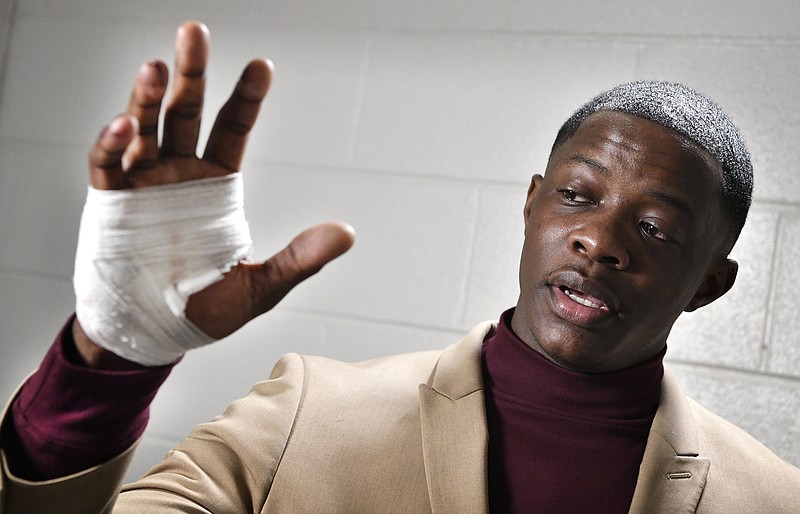 James Shaw Jr., shows his hand that was injured when he disarmed a shooter inside a Waffle House on Sunday, April 22, 2018, in Nashville, Tenn. A gunman stormed the Waffle House restaurant and shot several people to death before dawn, according to police, who credited Shaw, a customer with saving lives by wresting the assailant's weapon away. (Larry McCormack/The Tennessean via AP)