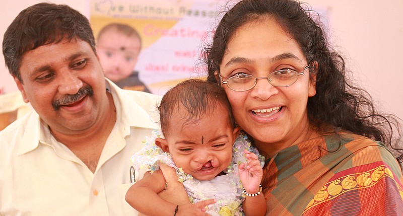 Susan and Santhosh Mathews, founders of Love Without Reason, hold a patient in India who received surgery with the aid of the organization.