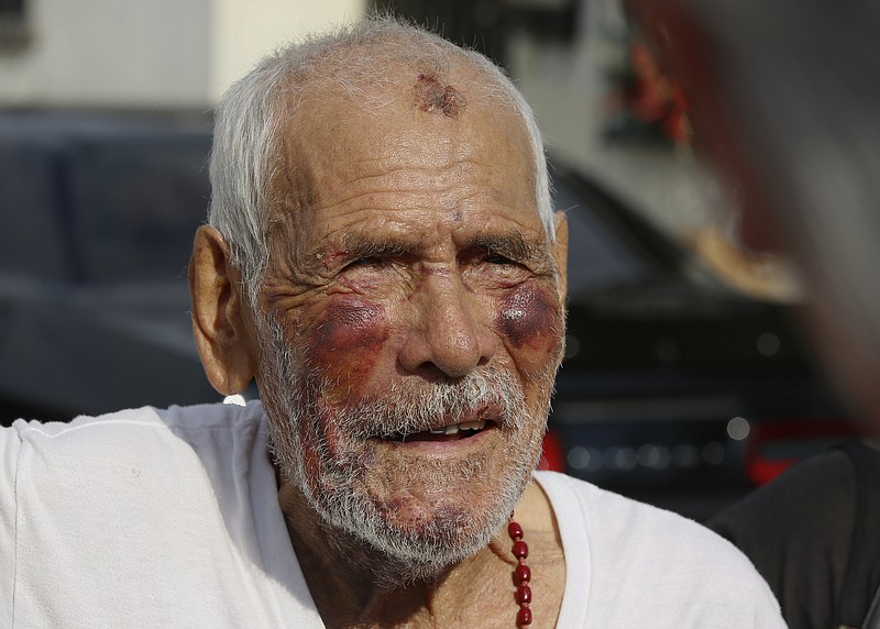 Rodolfo Rodriguez thanks well-wishers for their help, as he talks to the media gathered outside his home in Los Angeles Wednesday, July 11, 2018.