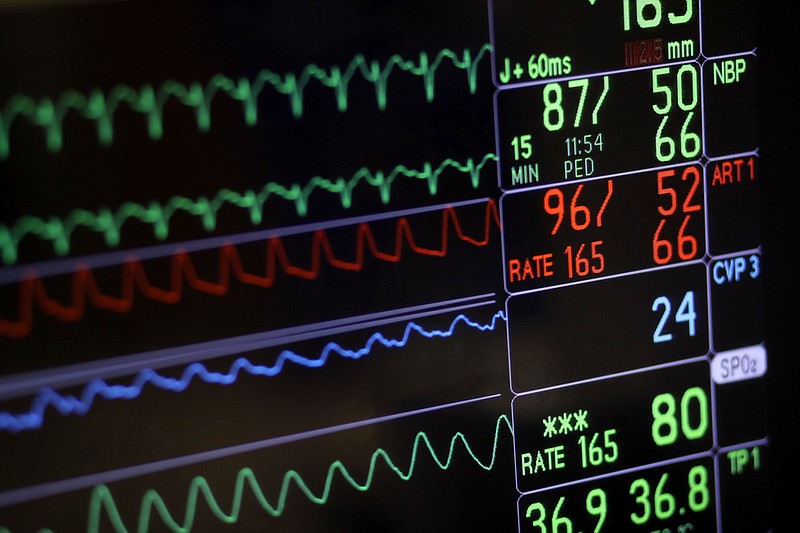 FILE- In this Nov. 28, 2016, file photo, a screen displays a patient's vital signs during open heart surgery at the University of Maryland Medical Center in Baltimore. U.S. hospitals are now required to post list prices for medical services online, under federal rules meant to help patients find affordable care and avoid hefty surprise bills. (AP Photo/Patrick Semansky, File)